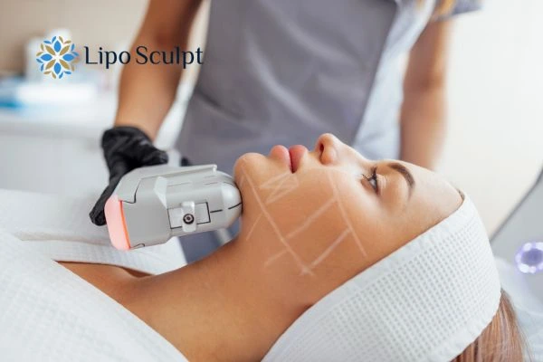 HIFU vs Botulinum Toxin: Understanding the Differences 1 HIFU vs Botox Falkirk What is the best option for you?