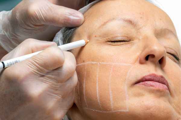 CryoPen: 5 Skin Concerns It May Be Used to Treat 4 What should you ask before having CryoPen treatment Falkirk?