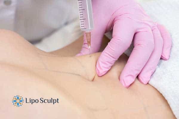 Aqualyx for Muffin Tops: What to Know Before Fat-Dissolving Injections 4 Are there risks Falkirk?